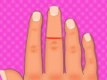 Hry Finger surgery