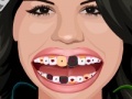 Hry Selena Gomez Perfect Teeth 